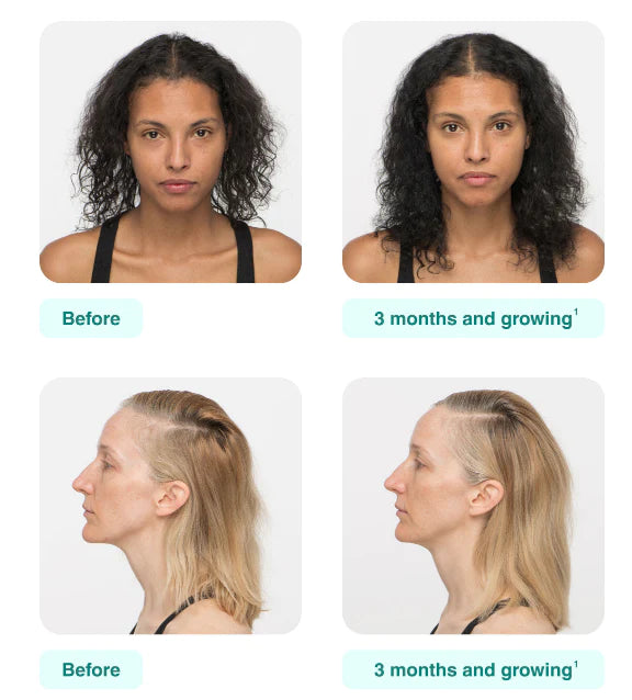 Nutrafol Women